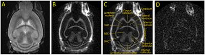 3D inversion recovery ultrashort echo time MRI can detect demyelination in cuprizone-treated mice